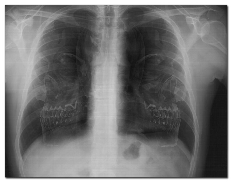 Photoshop Design by Dunga2_BANNED for DesignCrowd (Community Contests) | Design #9140583