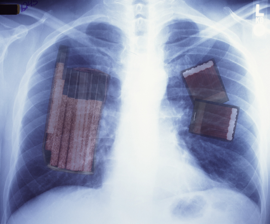 Design Photoshop par kakau7 pour DesignCrowd (Community Contests) | Design #9140596