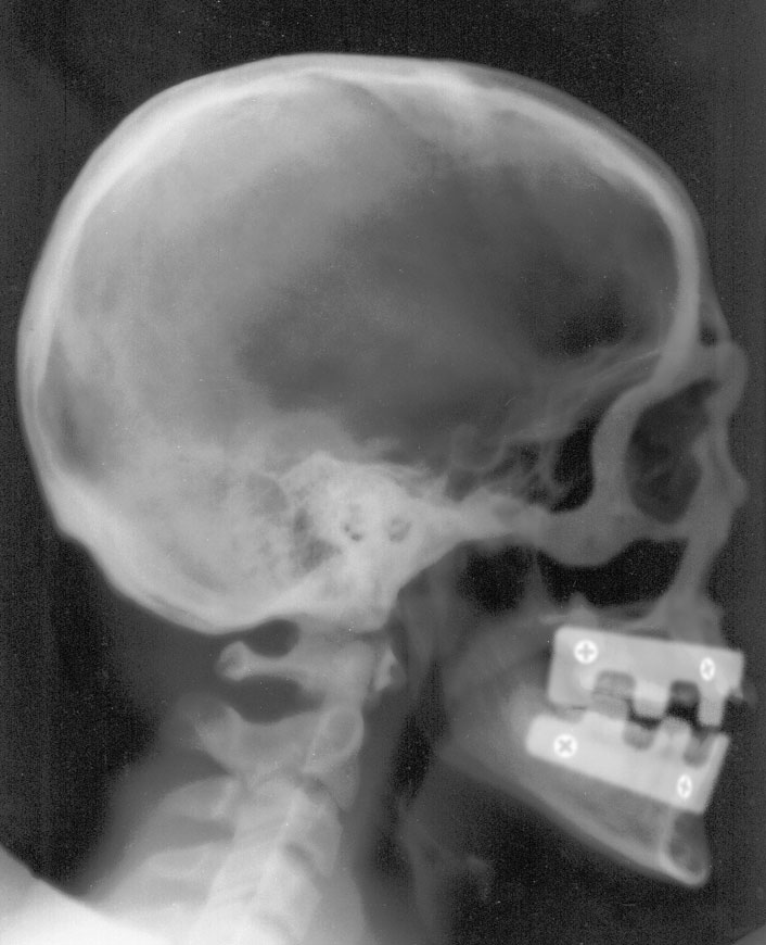 Photoshop Design by digsRus for DesignCrowd (Community Contests) | Design #9140610