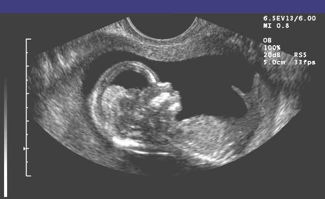 Photoshop Design by Jondor for DesignCrowd (Community Contests) | Design #9136903