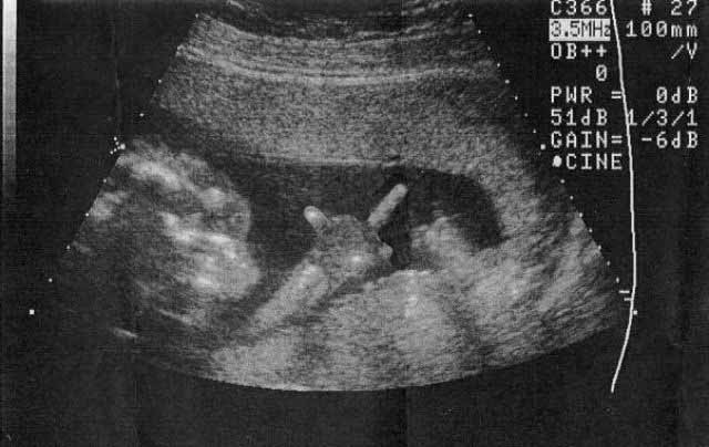 Photoshop Design by vipez for DesignCrowd (Community Contests) | Design #9136974