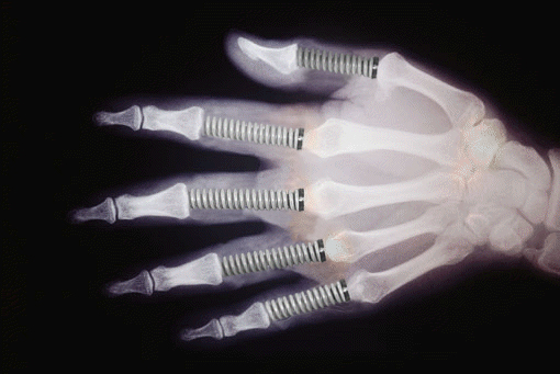 Diseño de Photoshop por fippsbozz para DesignCrowd (Community Contests) | Diseño #9136967