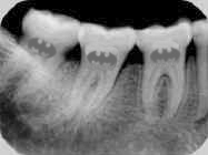 Photoshop Design by kremsersenf for DesignCrowd (Community Contests) | Design #9138339