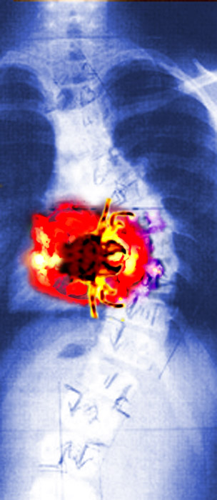 Photoshop Design by LeMolstad for DesignCrowd (Community Contests) | Design #9138300