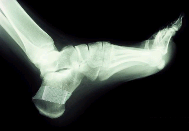 Diseño de Photoshop por cursors para DesignCrowd (Community Contests) | Diseño #9129625