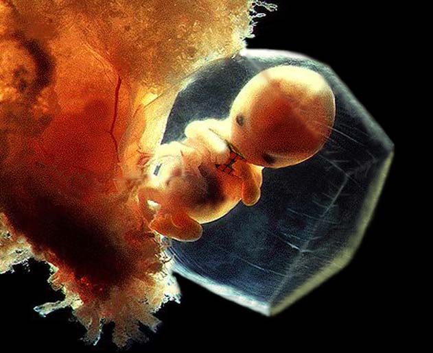 Photoshop-Design von ace2heart für DesignCrowd (Community Contests) | Design #9105281