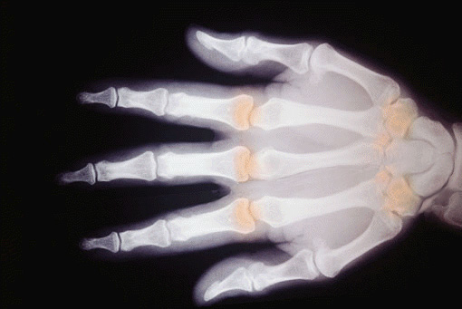 Photoshop Design by inbred for DesignCrowd (Community Contests) | Design #9113105