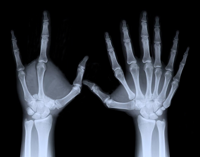 Photoshop Design by duragg for DesignCrowd (Community Contests) | Design #9113130