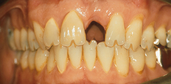 Photoshop Design by duragg for DesignCrowd (Community Contests) | Design #9128960