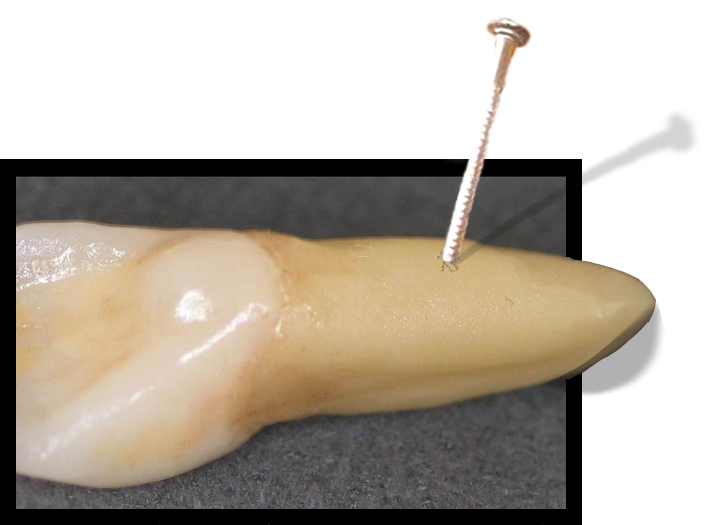 Photoshop Design by titojuante for DesignCrowd (Community Contests) | Design #9114840